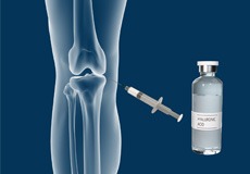 Combined Hyaluronic Therapy for the Knee